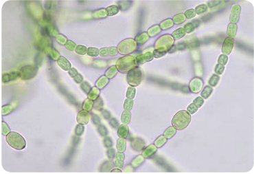 Microscopic view of <em>Anabaena azollae</em>