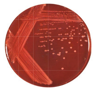 Pale pink mucoid colonies of <em>Rhizobium</em> on Yeast Extract Mannitol