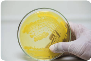 Growth of bacteria on Nutrient agar