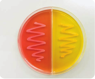 Growth of <em>Staphylococcus aureus</em> on Mannitol salt agar