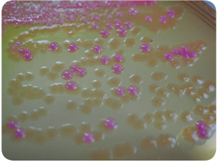 Growth of microorganisms on MacConkey agar (Lactose fermenting