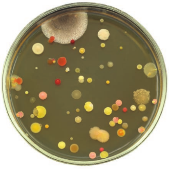 Settle plate technique showing bacterial and fungal growth