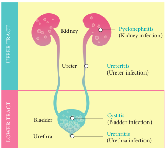 Structure of lower and upper urinary tract infection