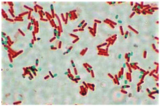 Schaeffer Fulton Endospore staining method- spores stained green