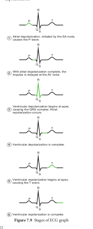 Stages of ECG graph