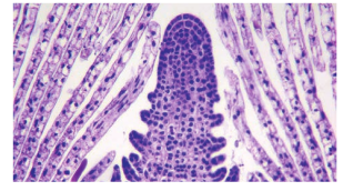 Figure 5.13: Shoot tip - Apical Meristem