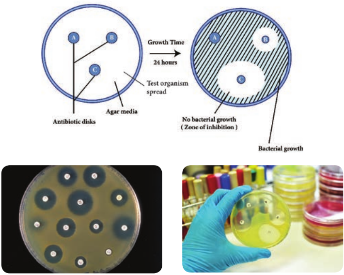  Microorganisms in Petri plate sh antibiotics