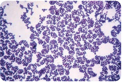  Gram staining of <em>Staphylococcus aureus</em>  