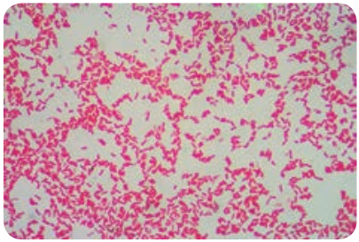  Gram staining of <em>Shigella</em>