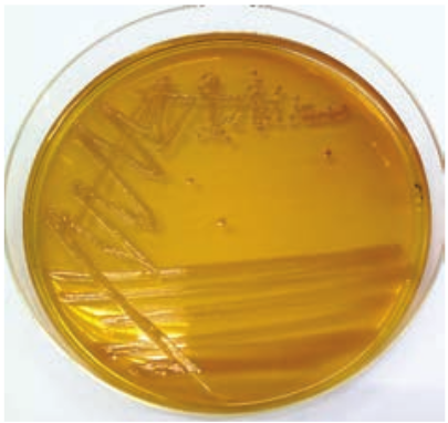  Colony morphology of <em>Shigella</em> on SS agar