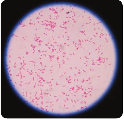  Gram staining of <em>Salmonella typhi</em>