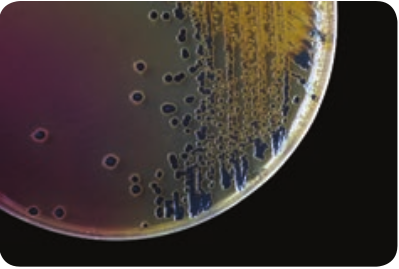  Colony morphology of <em>Salmonella typhi</em> on SS agar