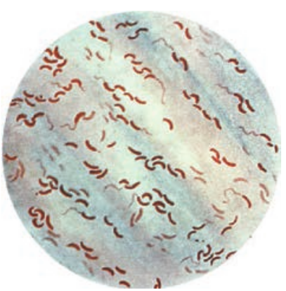  Gram staining of <em>Vibrio cholerae</em>