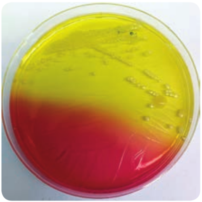  Colony morphology of <em>Staphylococcus aureus</em> on MSA