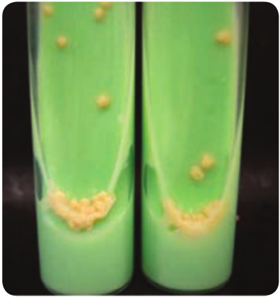  Colony morphology of _Mycobacterium tuberculosis_on LJ medium