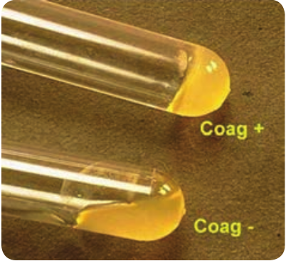  Skin infections caused by <em>Staphylococcus aureus</em>