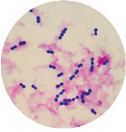  Gram staining of <em>Streptococcus pyogenes</em>