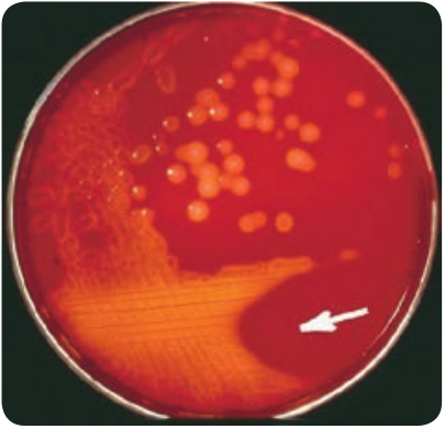  Colony morphology of <em>Streptococcus pyogenes</em> on blood agar  