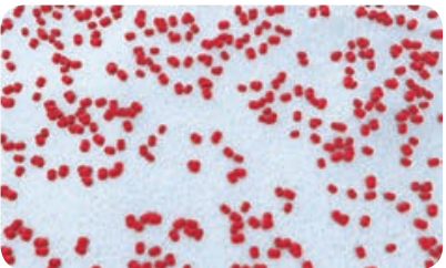  Gram staining of <em>Neisseria Meningitides</em>  