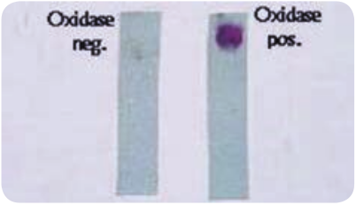  Oxidase test  