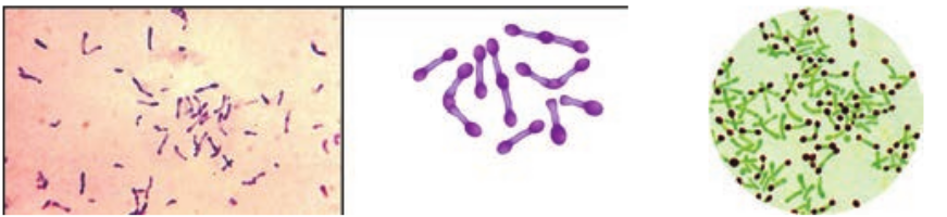  <strong>(a)</strong> Gram staining of <em>Corynebacter</em> showing metachromatic granules  