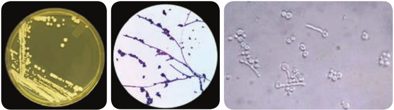  Candida <strong>(a)</strong> Macroscopic Morph <strong>(c)</strong> Germ tube  