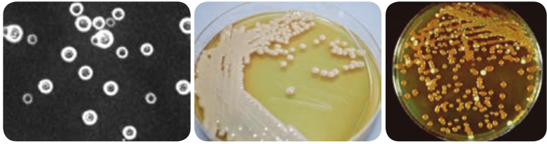  Cryptococcus <strong>(a)</strong> capsule de  