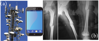 (a) Cell phone tower and cell phone (b) X-ray radiograph