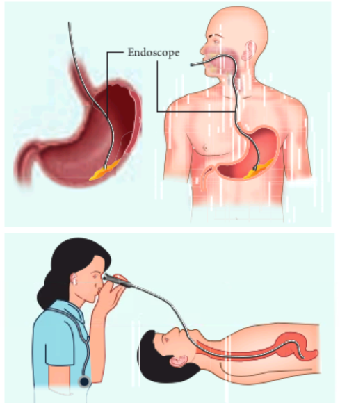 Endoscope